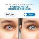 PURE EYES® Sterile Maximum Redness Relief Eye Drops - Pack of 12 (7mL)